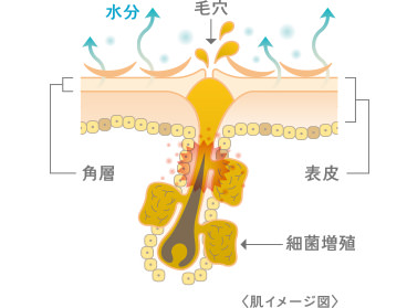 花粉の時期、肌イメージ図