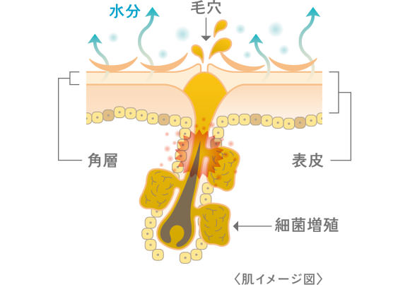 花粉の時期、肌イメージ図