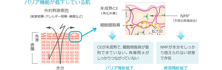 バリア機能が低下している肌