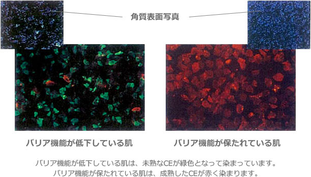 バリア機能が低下している肌とバリア機能が保たれている肌の角質表面