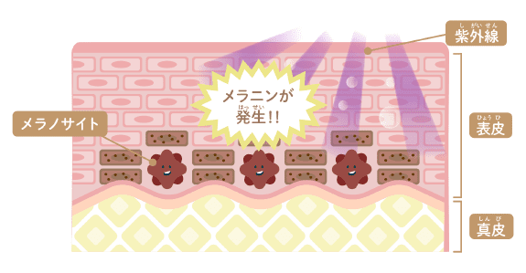 なんで日焼けやシミができるの?