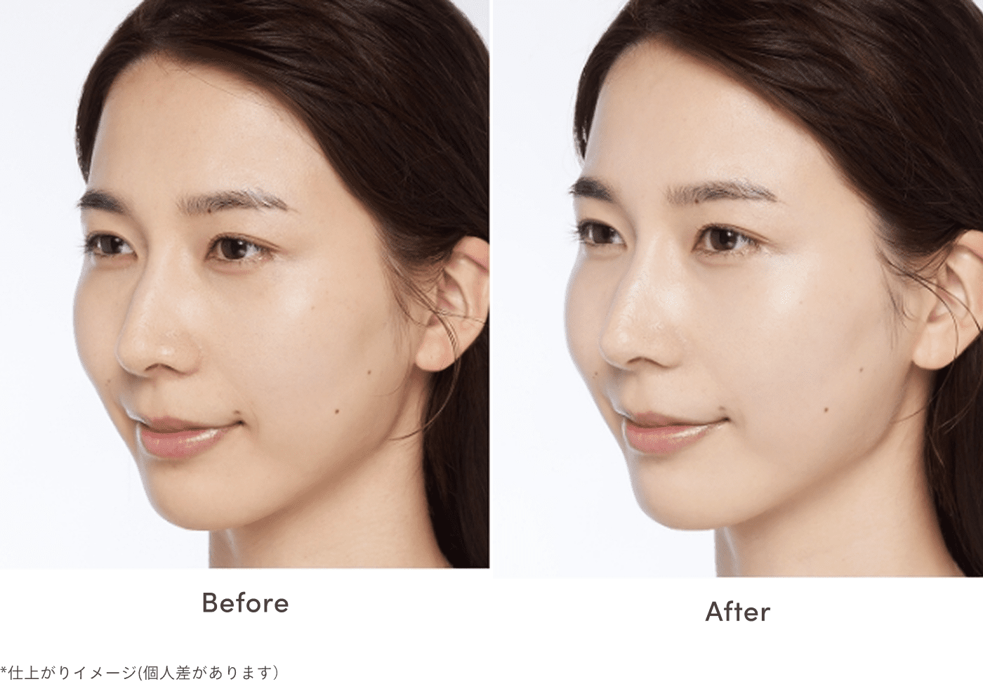 仕上がりのイメージ図