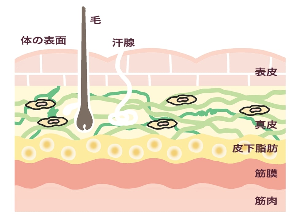 たるみの原因