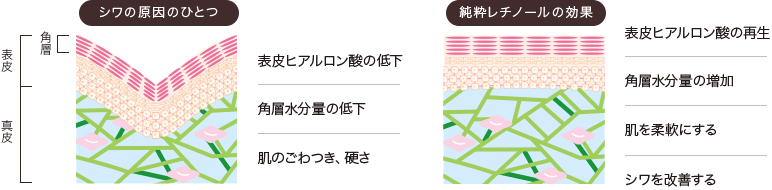 シワの原因のひとつ 表皮ヒアルロン酸の低下 角層水分量の低下 肌のごわつき、硬さ 純粋レチノールの効果 表皮ヒアルロン酸の再生 角層水分量の増加 肌を柔軟にする シワを改善する