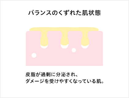 バランスのくずれた肌状態：皮脂が過剰に分泌され、ダメージを受けやすくなっている肌。