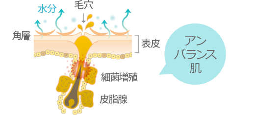 アンバランス肌の断面図