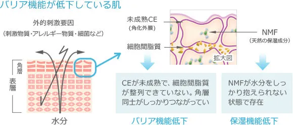 バリア機能が低下している肌