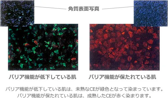 バリア機能が低下している肌とバリア機能が保たれている肌の角質表面