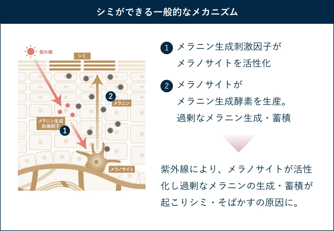シミができる一般的なメカニズム