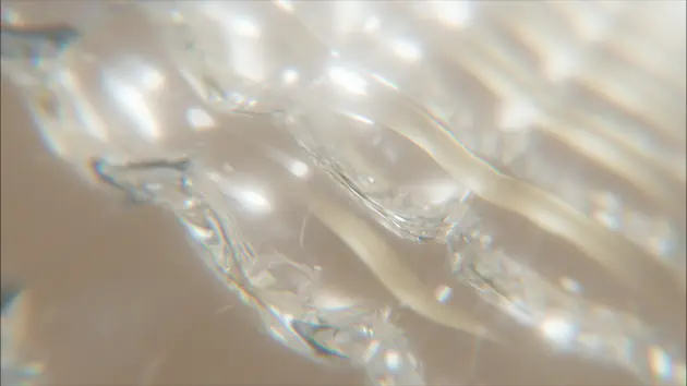 シミができる一般的なメカニズム