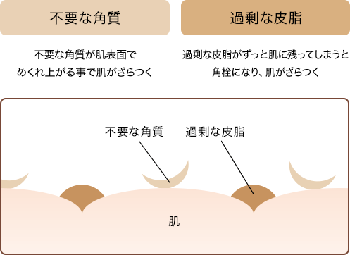 不要な角質・過剰な皮脂によるざらつき