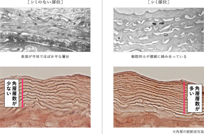 シミ予防研究所の進化 シミ予防研究所 Haku ハク 資生堂 シミ 美白化粧品 シミ予防研究所の進化 シミ予防研究所 Haku ハク 資生堂 シミ 美白化粧品