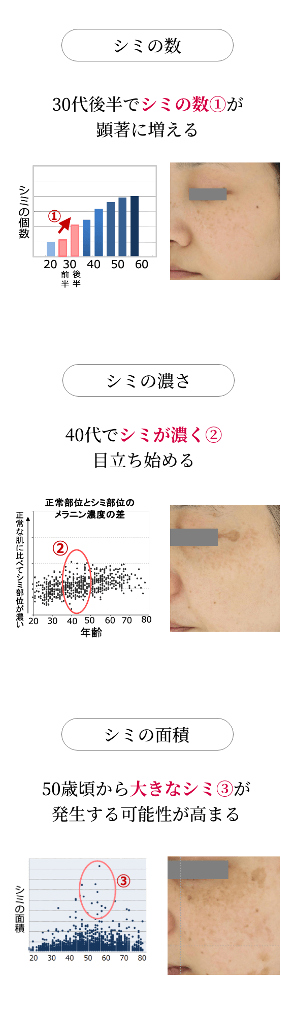 シミ予防研究所 資生堂 シミ予防研究所 資生堂