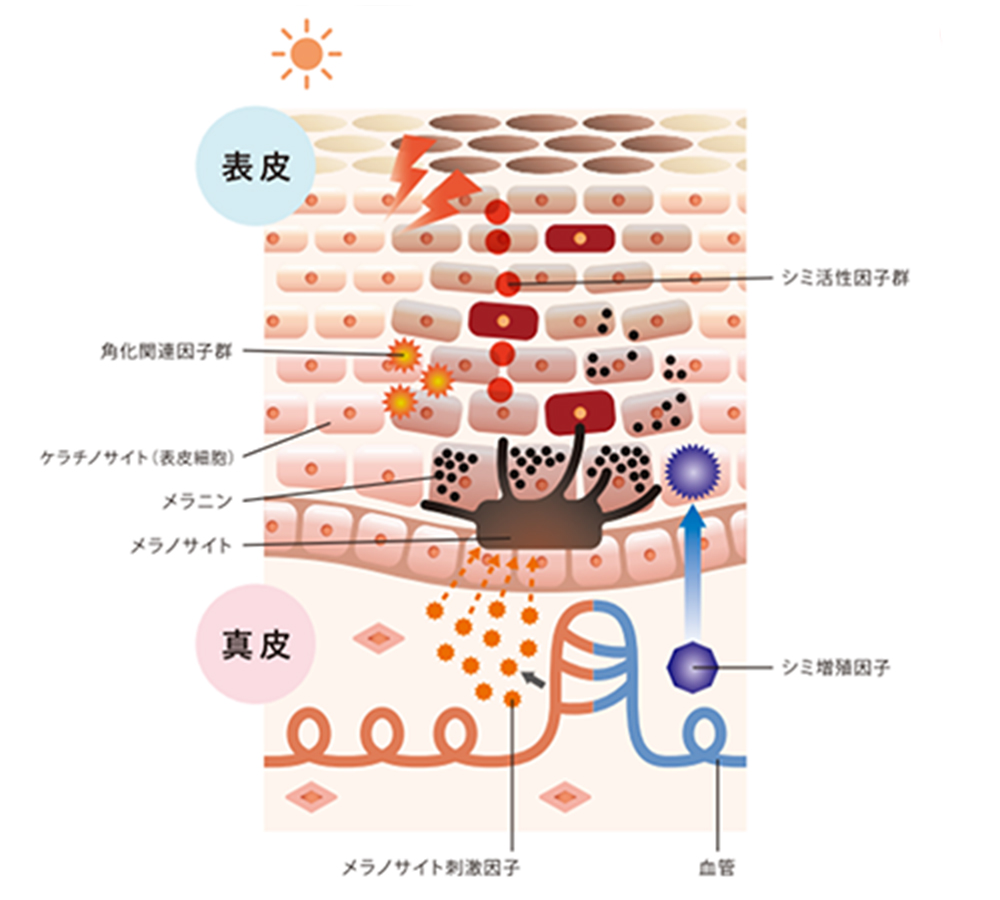 シミの原因のイメージ図