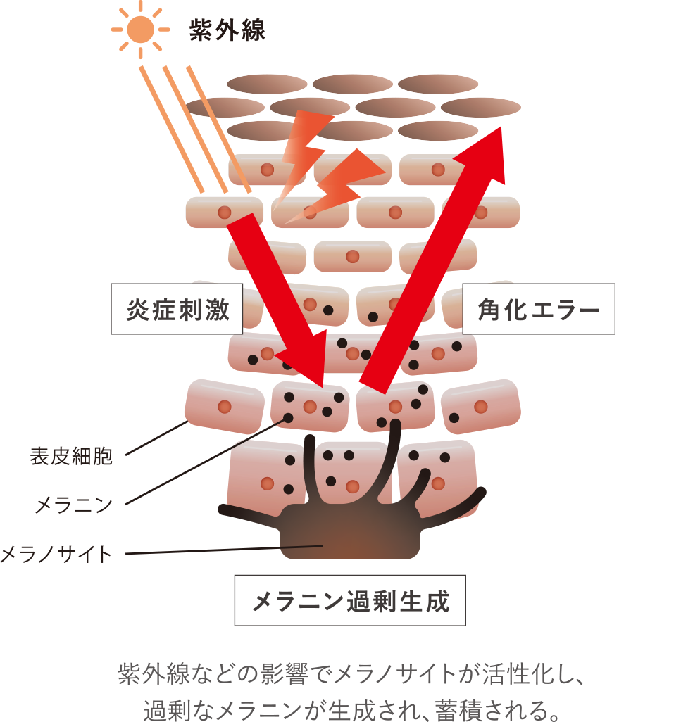 紫外線などの影響でメラノサイトが活性化し、過剰なメラニンが生成され、蓄積される。