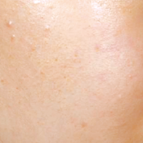 薬用 美白マスクが9.21新登場。