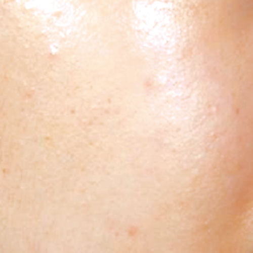 薬用 美白マスクが9.21新登場。