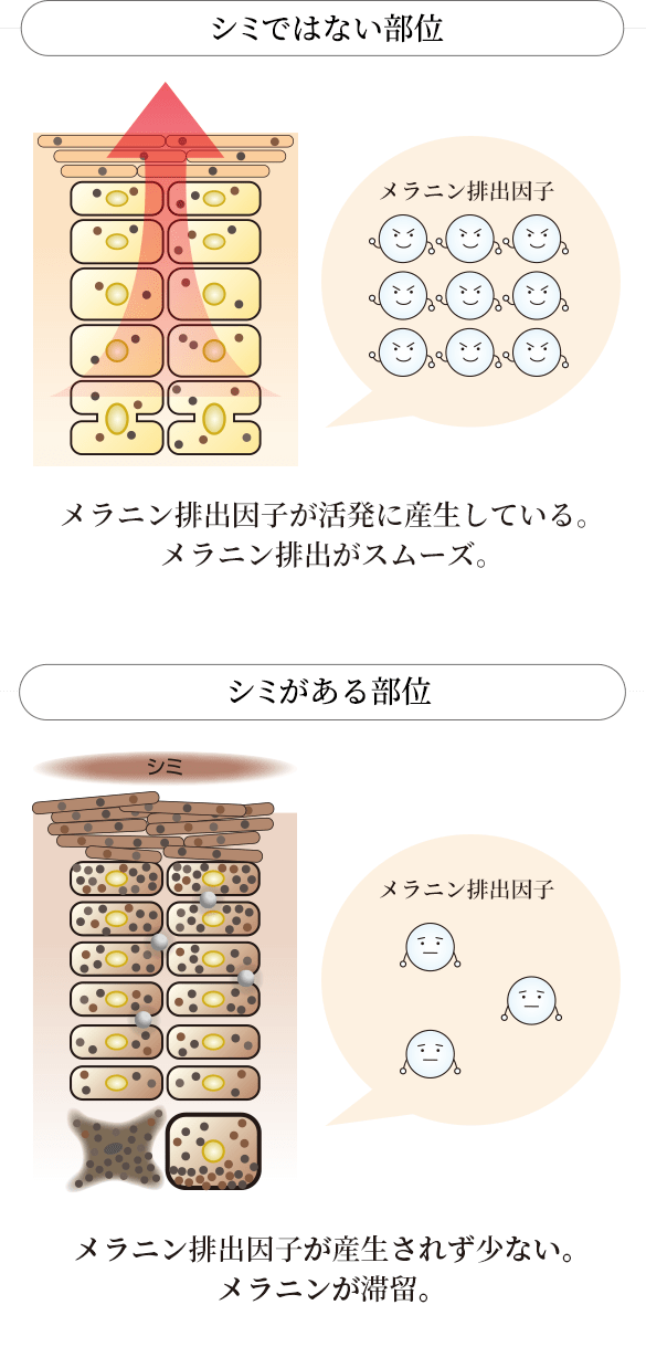 シミではない部位：メラニン排出因子が活発に産生している。メラニン排出がスムーズ。シミがある部位：メラニン排出因子が産生されず少ない。メラニンが滞留。