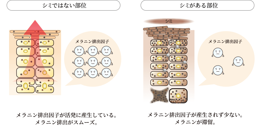 シミではない部位：メラニン排出因子が活発に産生している。メラニン排出がスムーズ。シミがある部位：メラニン排出因子が産生されず少ない。メラニンが滞留。