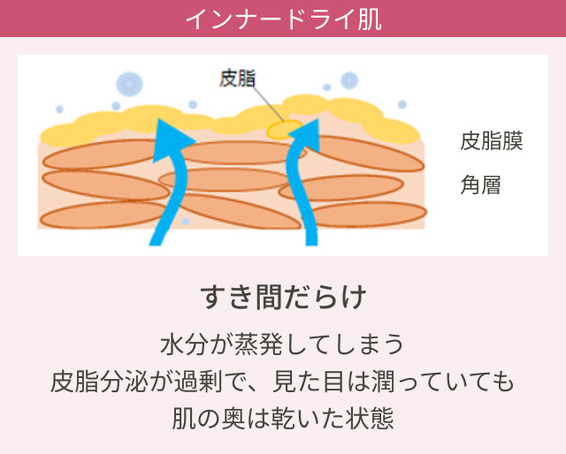 イラスト：インナードライ肌 すき間だらけで水分が蒸発してしまうイラスト