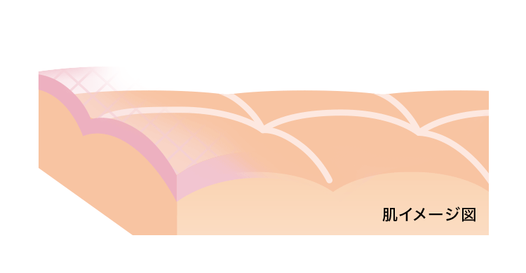 肌コルセット技術