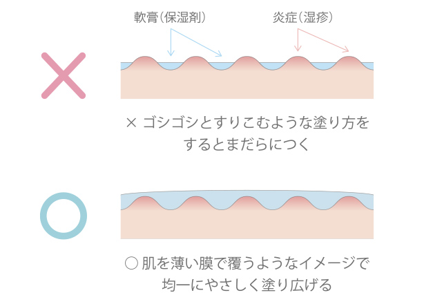 新生児から始めたいアトピー性皮膚炎を防ぐための保湿ケア 1000の真実 資生堂