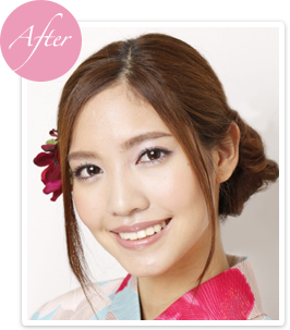After