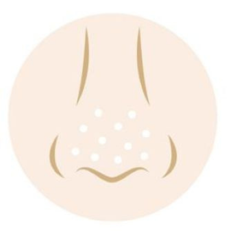 開き毛穴の画像