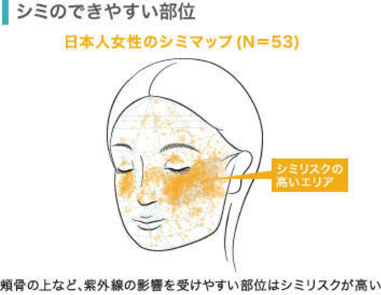 シミができやすい部位