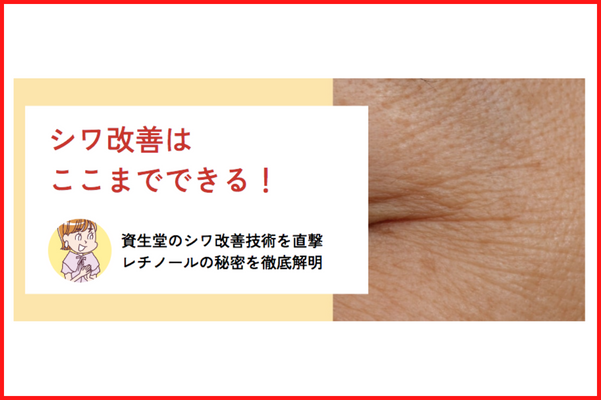 シワ改善はここまでできる！資生堂のシワ改善技術を直撃、レチノールの秘密を徹底解明