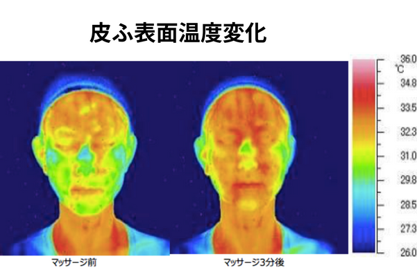 皮ふ表面温度変化の様子