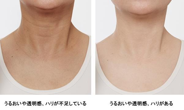 うるおいや透明感、ハリが不足している首・デコルテと、うるおいや透明感、ハリがある首・デコルテ