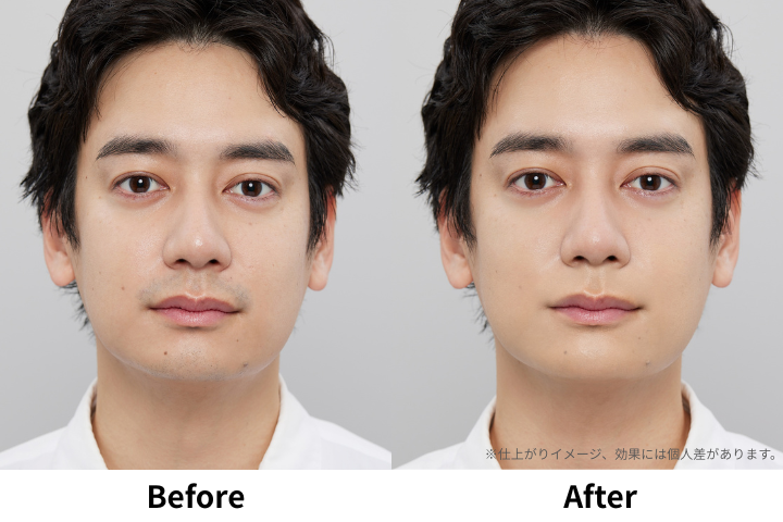 青ひげカバーのBeforeとAfter