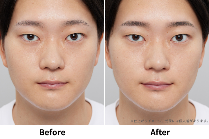 薄眉のBeforeとAfter
