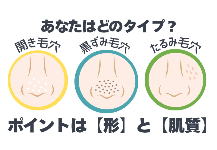 開き毛穴、黒ずみ毛穴、たるみ毛穴の画像