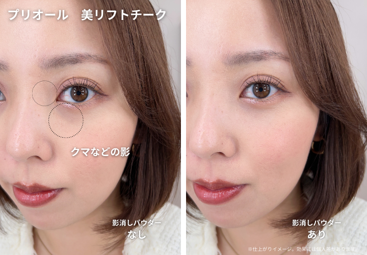 プリオール 美リフトチーク　比較画像