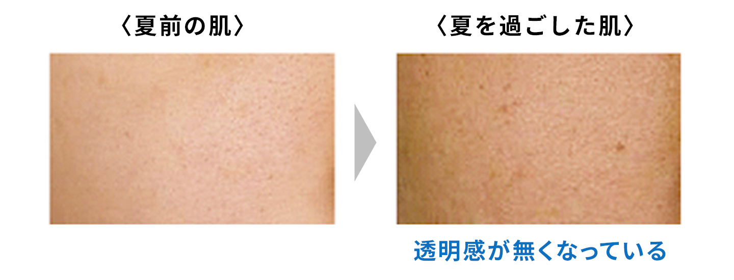 夏前の肌と夏を過ごした肌の画像。後者は透明感が無くなっている。