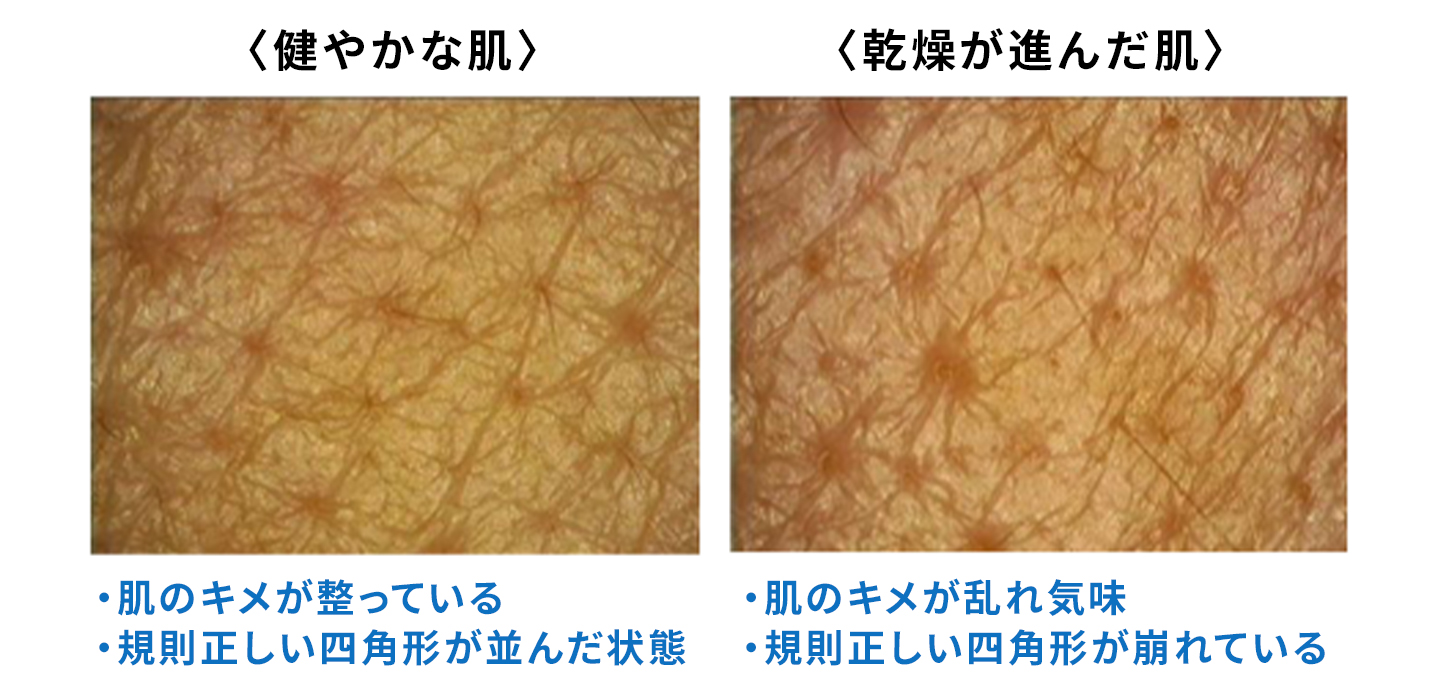 健やかな肌の画像。肌のキメが整っている。規則正しい四角形が並んだ状態。乾燥が進んだ肌の画像。肌のキメが乱れ気味。規則正しい四角形が崩れている。