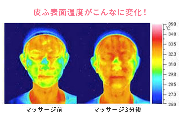 皮ふ表面温度変化のサーモグラフィー