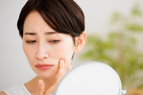 女性が不安そうに自分の肌を鏡で見ている写真。