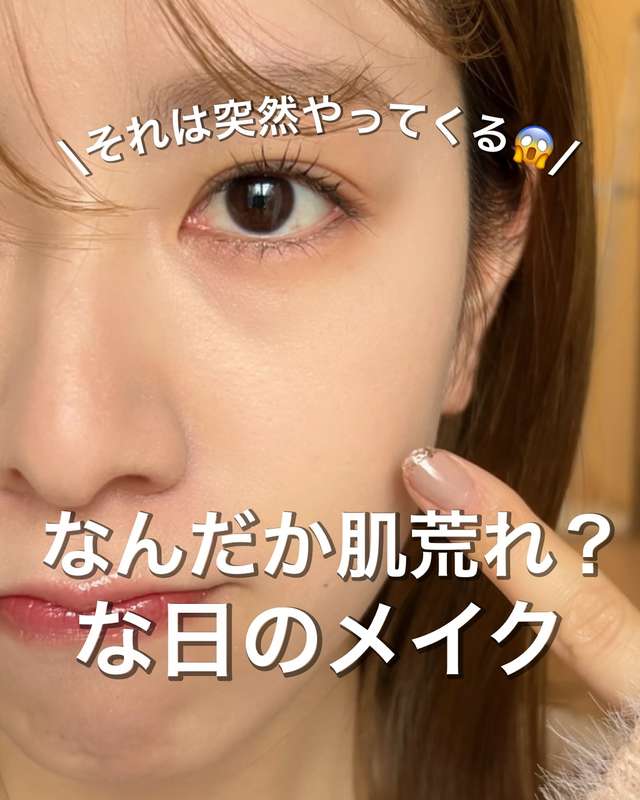 肌荒れに悩んでいる表情の資生堂美容部員のれなコの写真です