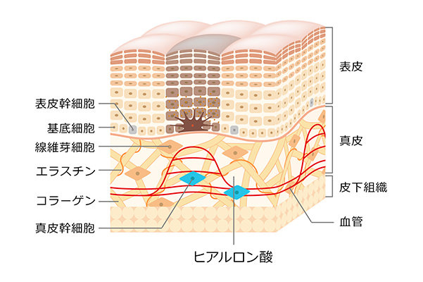 消す たるみ