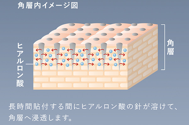 １シートに1,200本の針状ヒアルロン酸!? 「HAフィルパッチ」の魅力