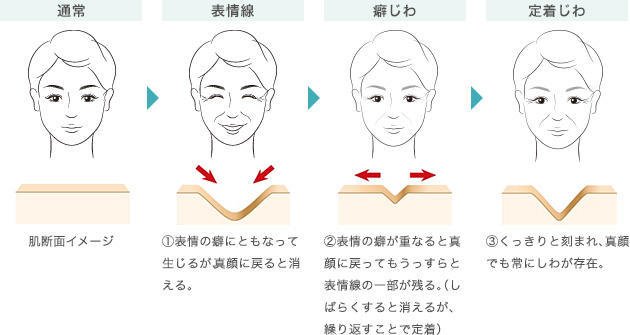 知って なるほど化粧品 シワは なぜできるの 美容の情報 ワタシプラス 資生堂