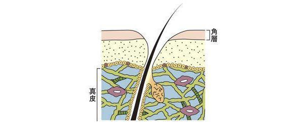肌イメージ図