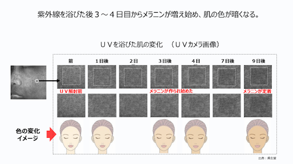 シミのもととなるメラニンの定着