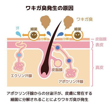 ワキガ臭発生の原因