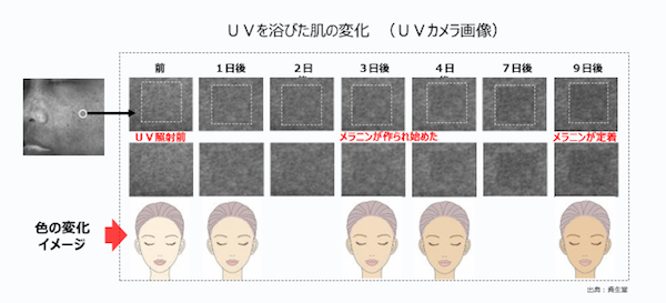 日焼け後の色の変化