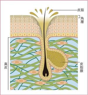 【原因②　皮脂】皮脂毛穴が気になる肌の状態とは？