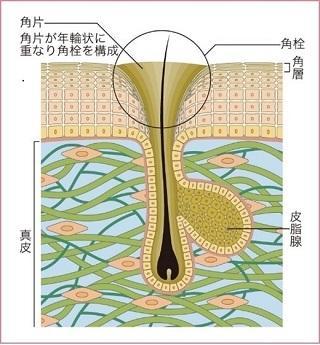 毛穴の黒ずみができる原因